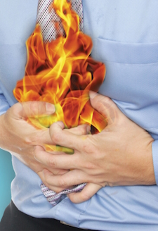 Relieving Heartburn Without the Risks of PPI Drugs